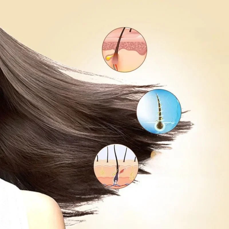 Sulfur Shampoo for Lice, Mites, Dandruff, and Itching – Oil Control, Deep Cleaning, Damage Repair