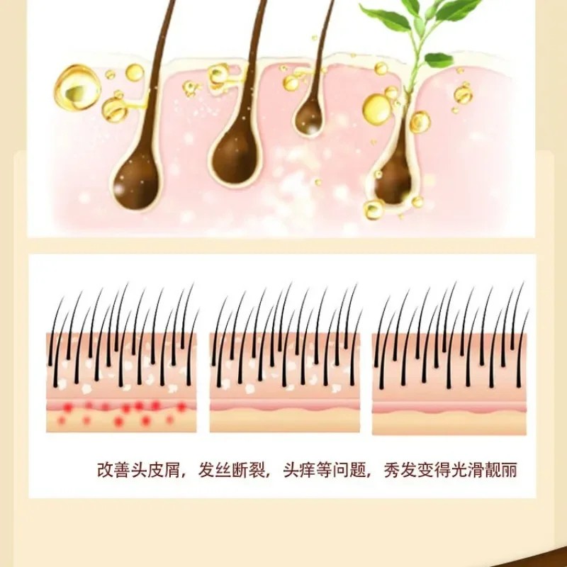 Sulfur Shampoo for Lice, Mites, Dandruff, and Itching – Oil Control, Deep Cleaning, Damage Repair