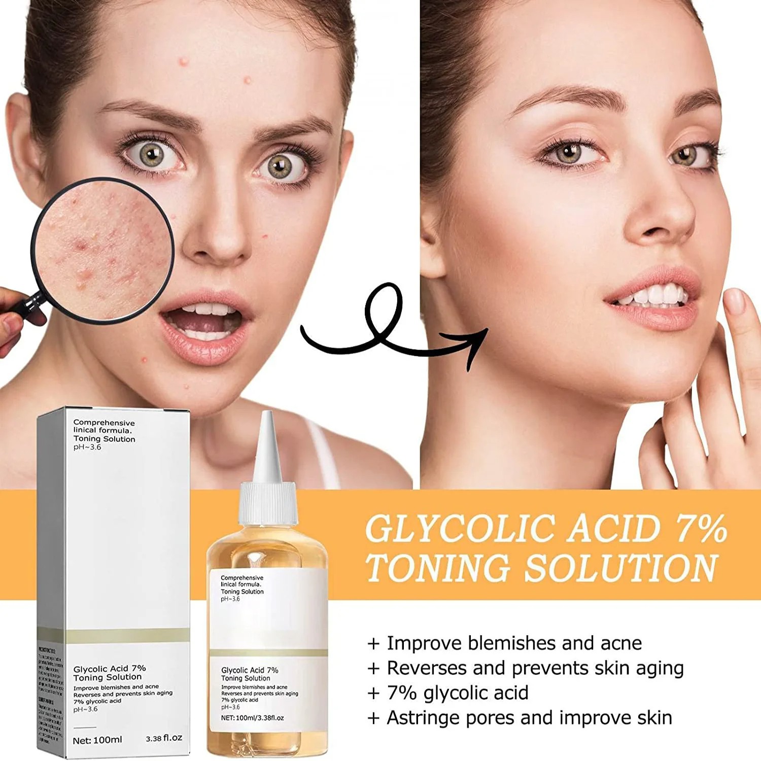 Glycolic Acid 7% Toning Solution - Acne Removal, Skin Moisturizing, Rejuvenating Lotion, and Gentle Exfoliating Toner