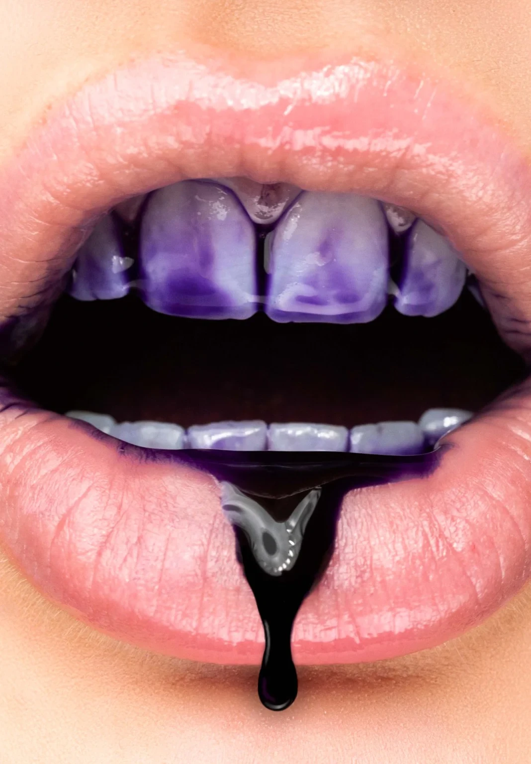 Blanqueamiento del color de los dientes