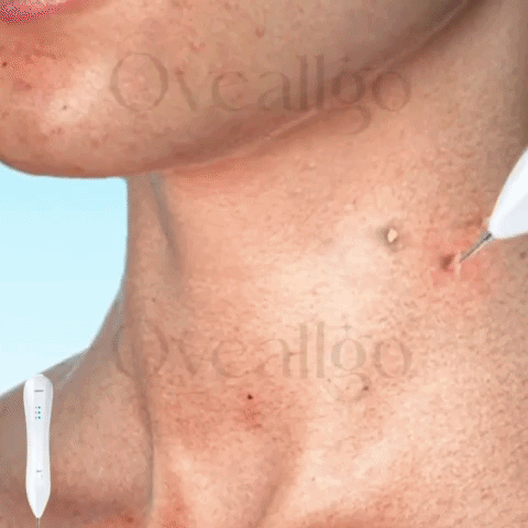 Herramienta de belleza profesional
