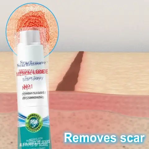 Spray avanzado para todo tipo de cicatrices, como cicatrices de acné, quirúrgicas y estrías.