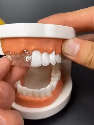 Relleno de huecos dentales