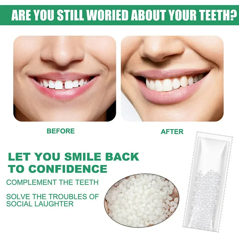 Kit de reparación de dientes temporales moldeables