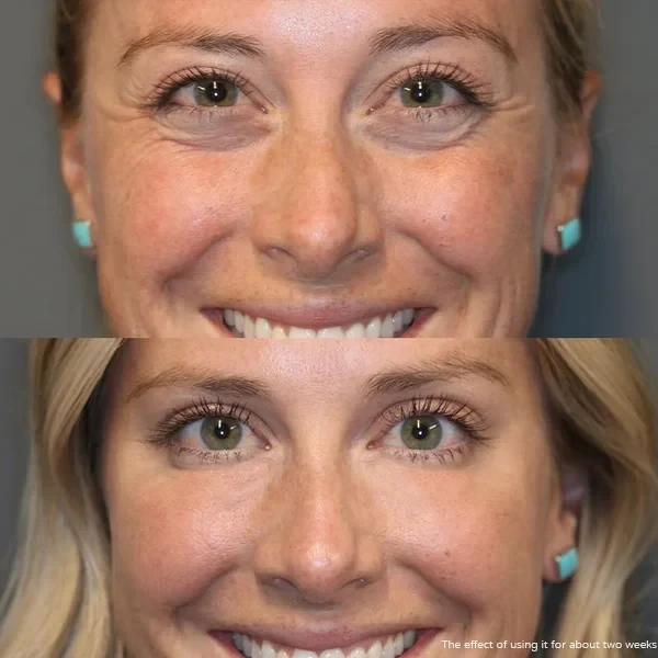 Crema para ojos en barra con retinol