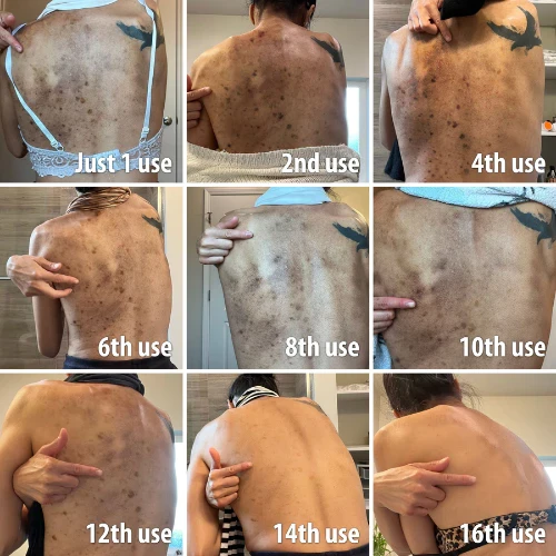 Suero iluminador corrector de melanina AQA: tratamiento avanzado antiedad y antimanchas