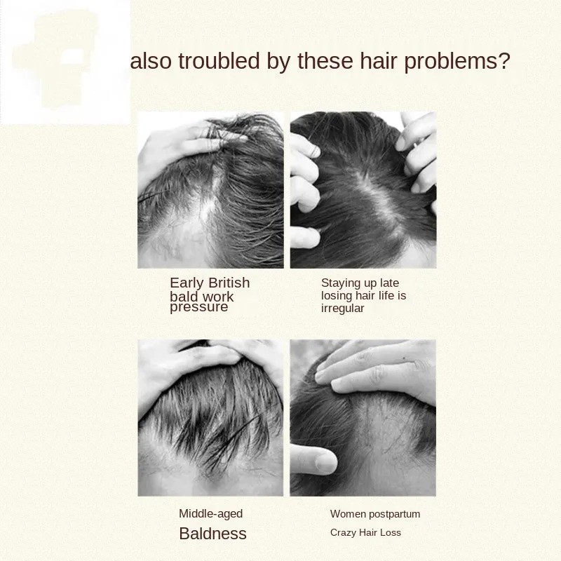 Peine para el cabello Beam, microcorriente, radiofrecuencia, crecimiento del cabello