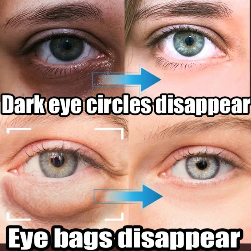 Crema para eliminar bolsas de los ojos al instante: colágeno, antiarrugas, reafirmante y iluminadora.