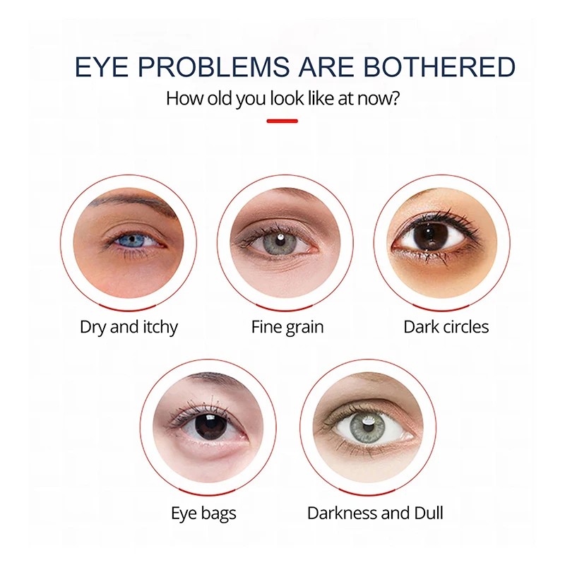 Crema antiarrugas para ojos con retinol: elimina ojeras, bolsas y bolsas debajo de los ojos.