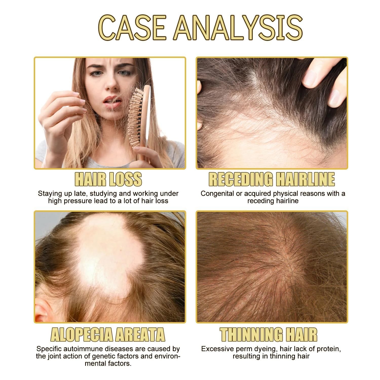 Aceite vegano natural para el crecimiento del cabello: aceite esencial nutritivo y anticaída para el engrosamiento y la reparación del cabello.