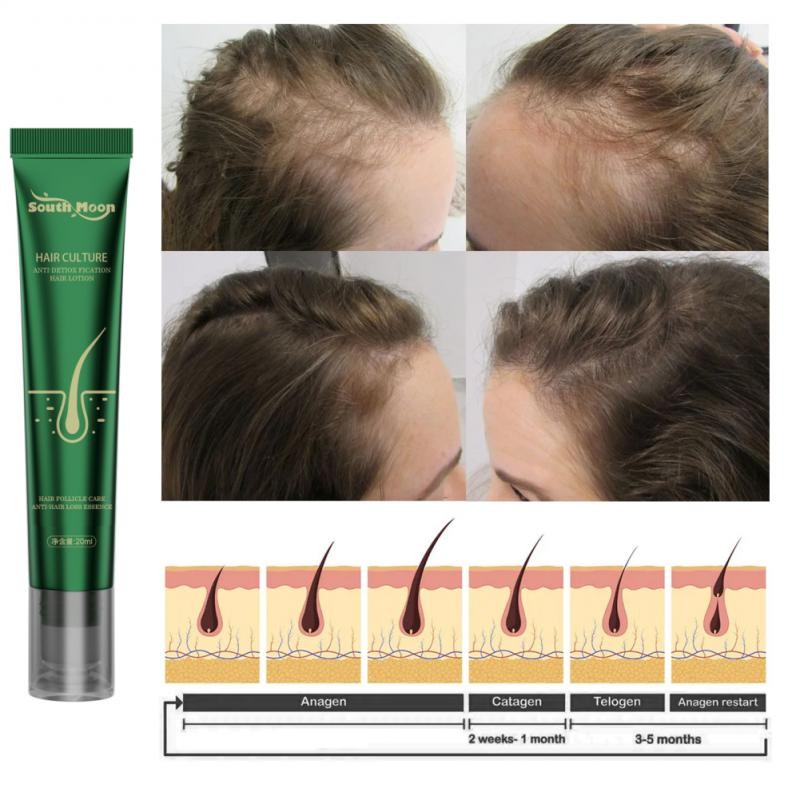Esencia anticrecimiento capilar South Moon: fortalece el cabello y repara el daño de las raíces con acondicionador de jengibre.