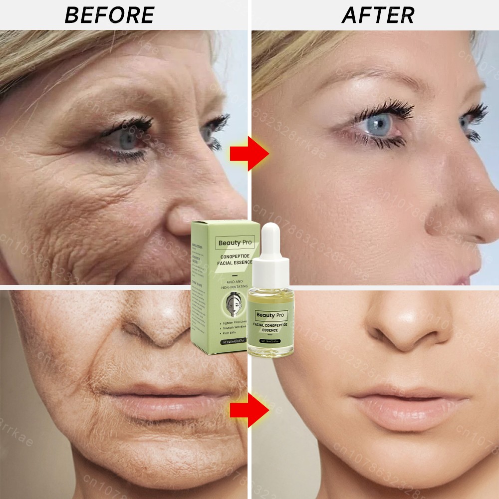 Suero facial antiarrugas: esencia reafirmante y reafirmante antiedad