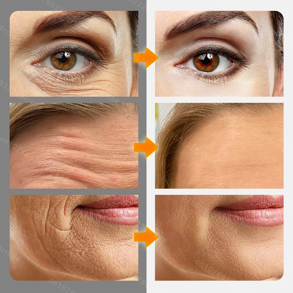 Suero facial antiarrugas: esencia reafirmante y reafirmante antiedad