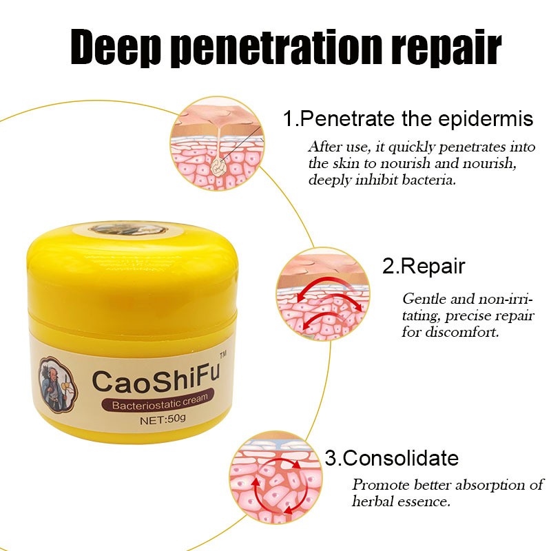Crema Caoshifu para la psoriasis - 4 pomadas de hierbas para la piel (50 g)