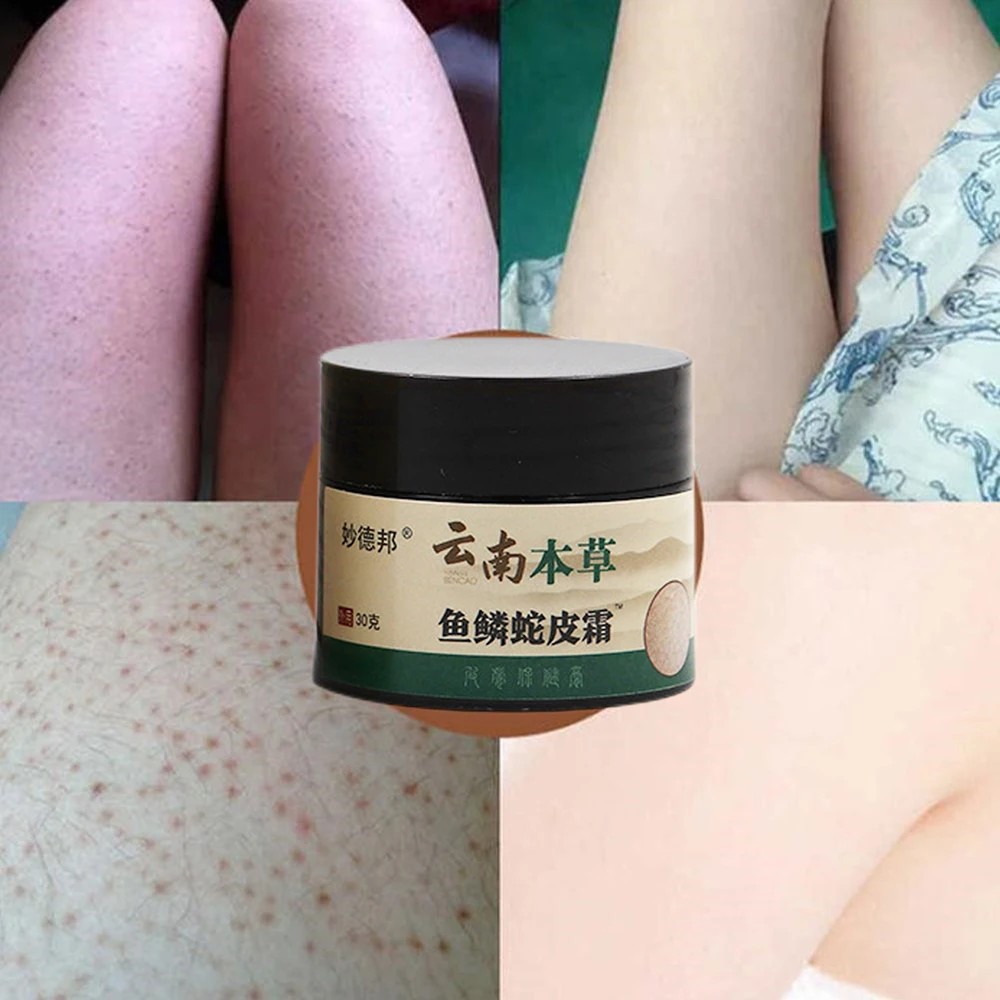 Crema Reparadora de Piel de Pollo - Tratamiento para la Queratosis Pilaris y Alisamiento de Poros