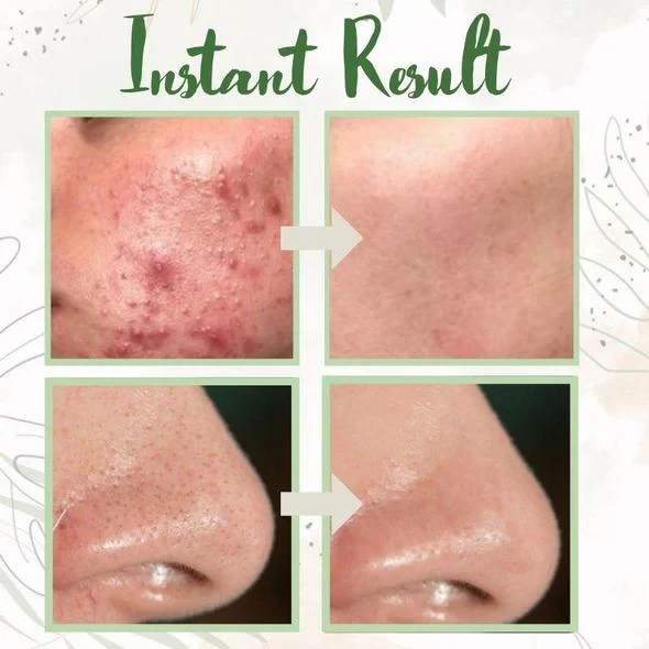 Mascarilla de limpieza profunda de té verde