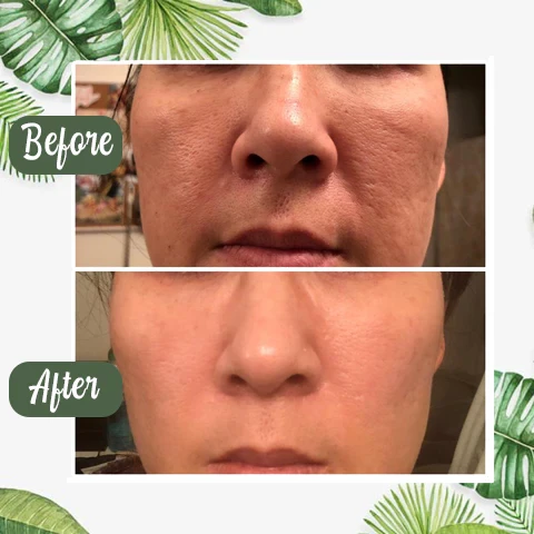 Mascarilla de limpieza profunda de té verde