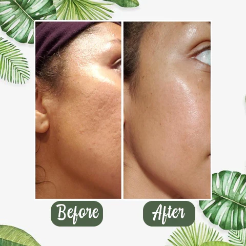 Mascarilla de limpieza profunda de té verde