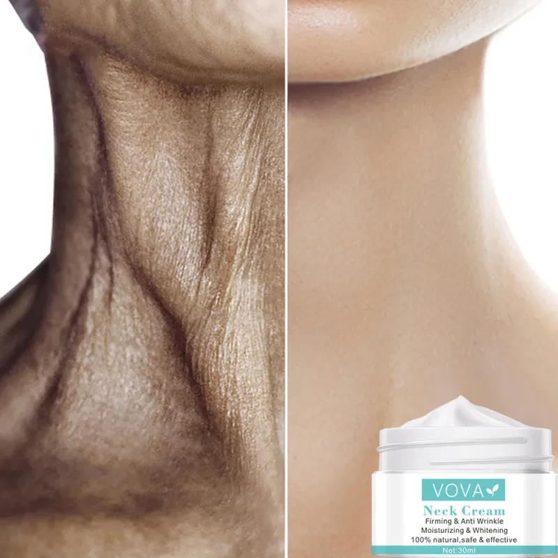 Crema para el cuello