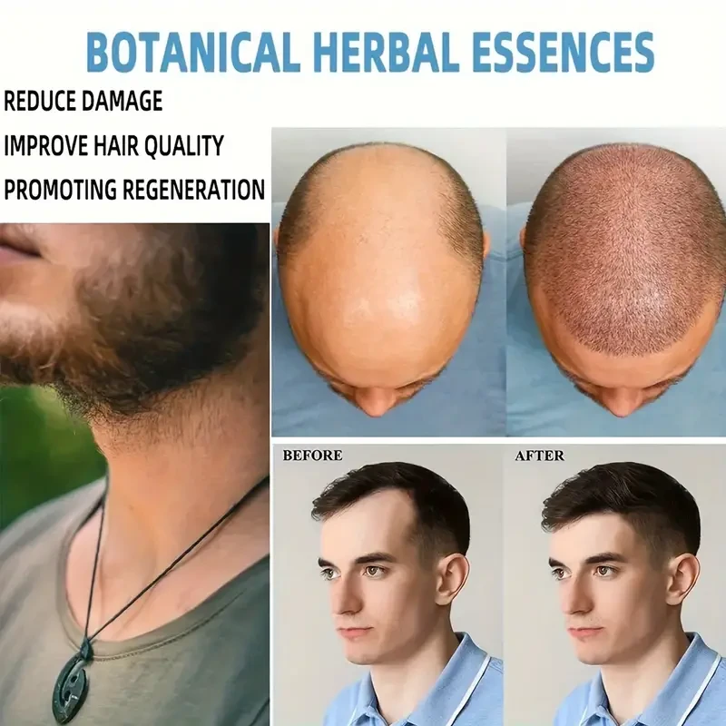 Crema capilar enriquecida con biotina y vitaminas para un cabello más grueso, largo, abundante y saludable.