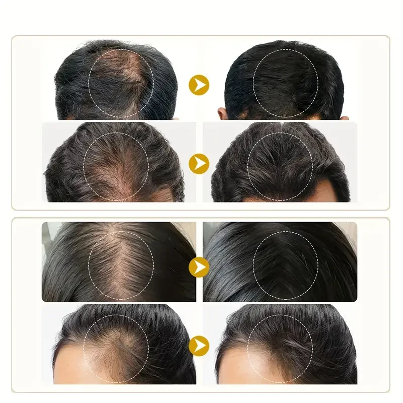 Crema capilar enriquecida con biotina y vitaminas para un cabello más grueso, largo, abundante y saludable.