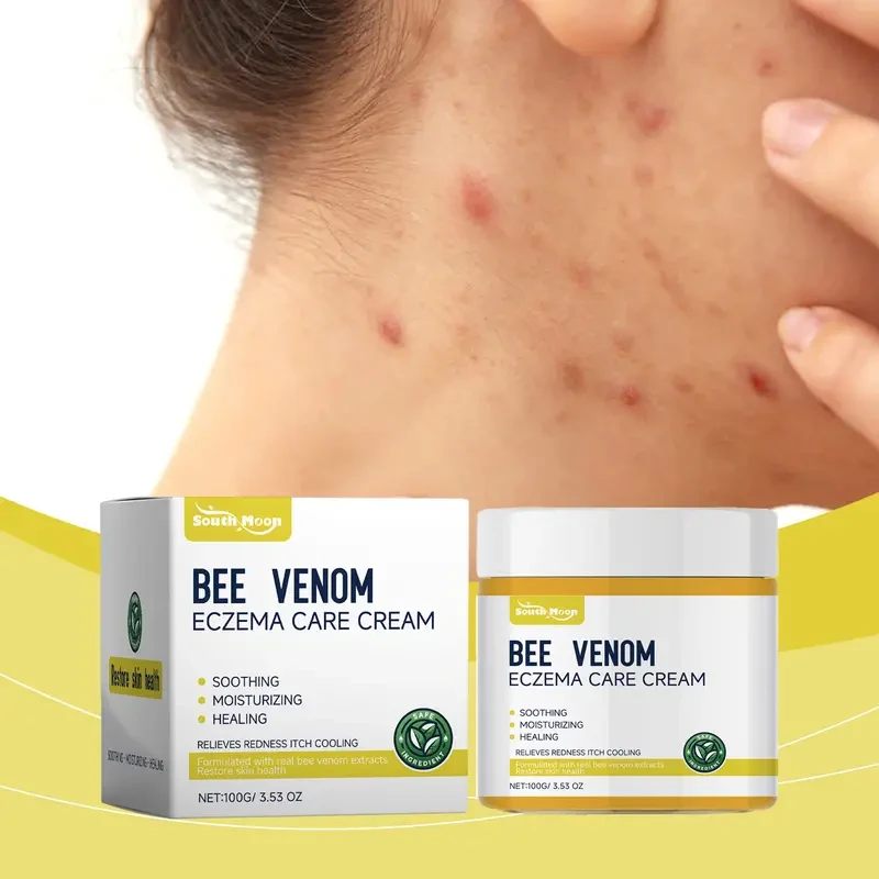 Crema para el eczema con veneno de abeja: alivio calmante e hidratante para todo tipo de piel