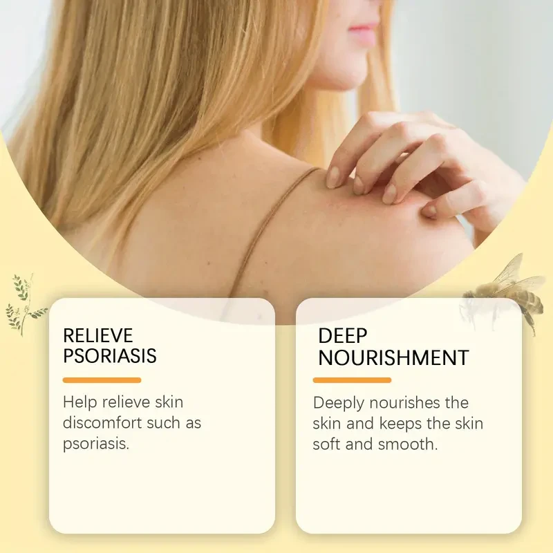 Crema para el eczema con veneno de abeja: alivio calmante e hidratante para todo tipo de piel