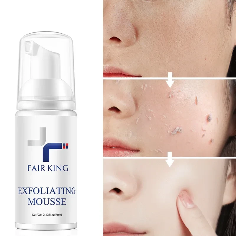 Mousse exfoliante para el cuidado de la piel de 60 ml
