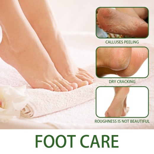 Solución exfoliante para el cuidado de la piel y las grietas en los callos del talón.