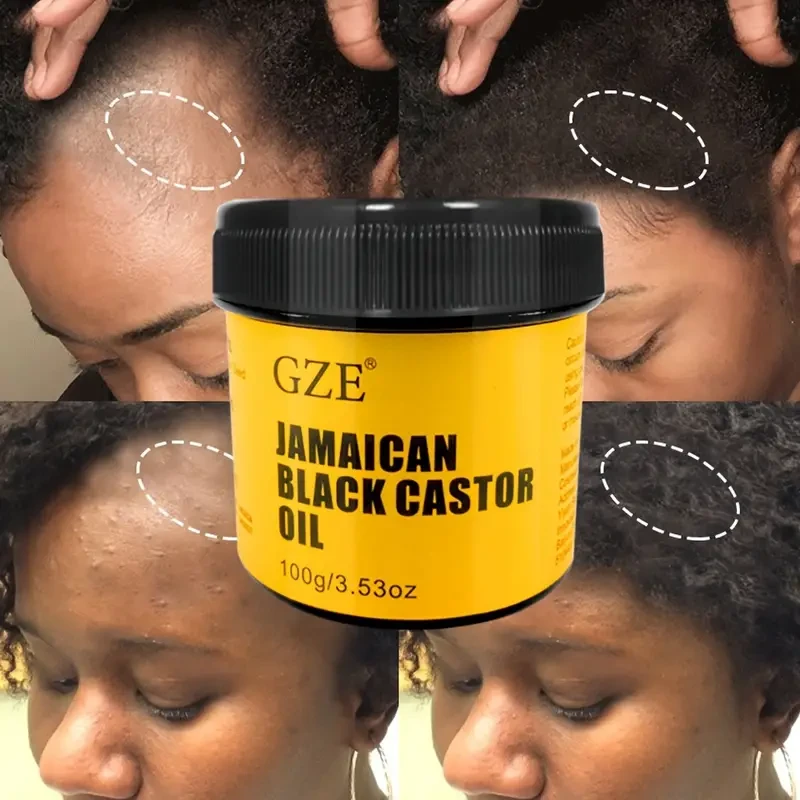 Aceite de ricino negro de Jamaica: puro, prensado en frío para un cabello más fuerte y una piel más sana.