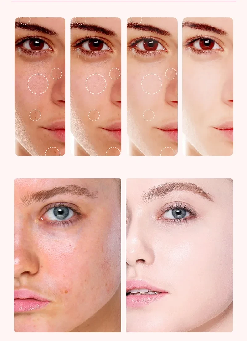 La nicotinamida aclara el tono de la piel y reduce las líneas finas.