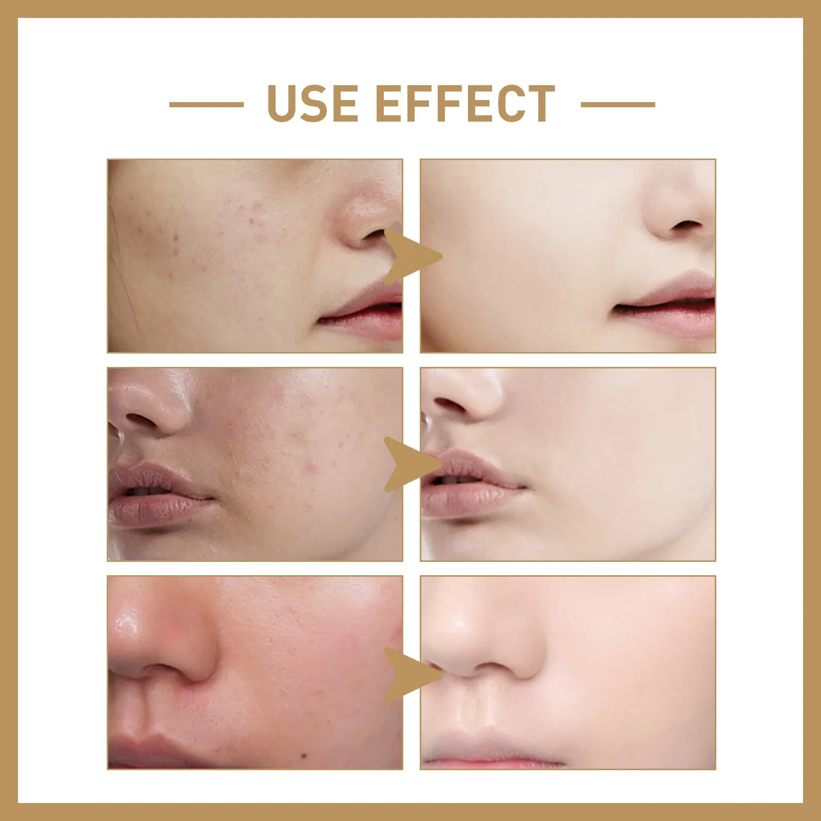 Loción facial suave reafirmante e hidratante profunda que repara la barrera cutánea.