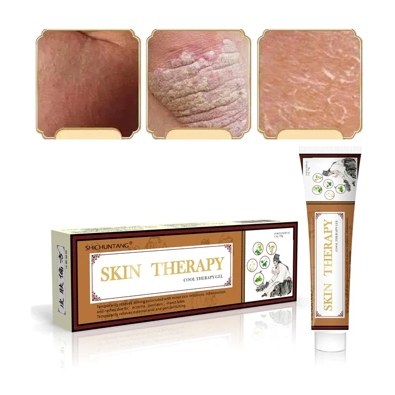 Crema para la psoriasis Piel Loción para el cuidado de la piel