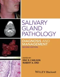 Patología de las glándulas salivales