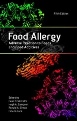 Alergia alimentaria