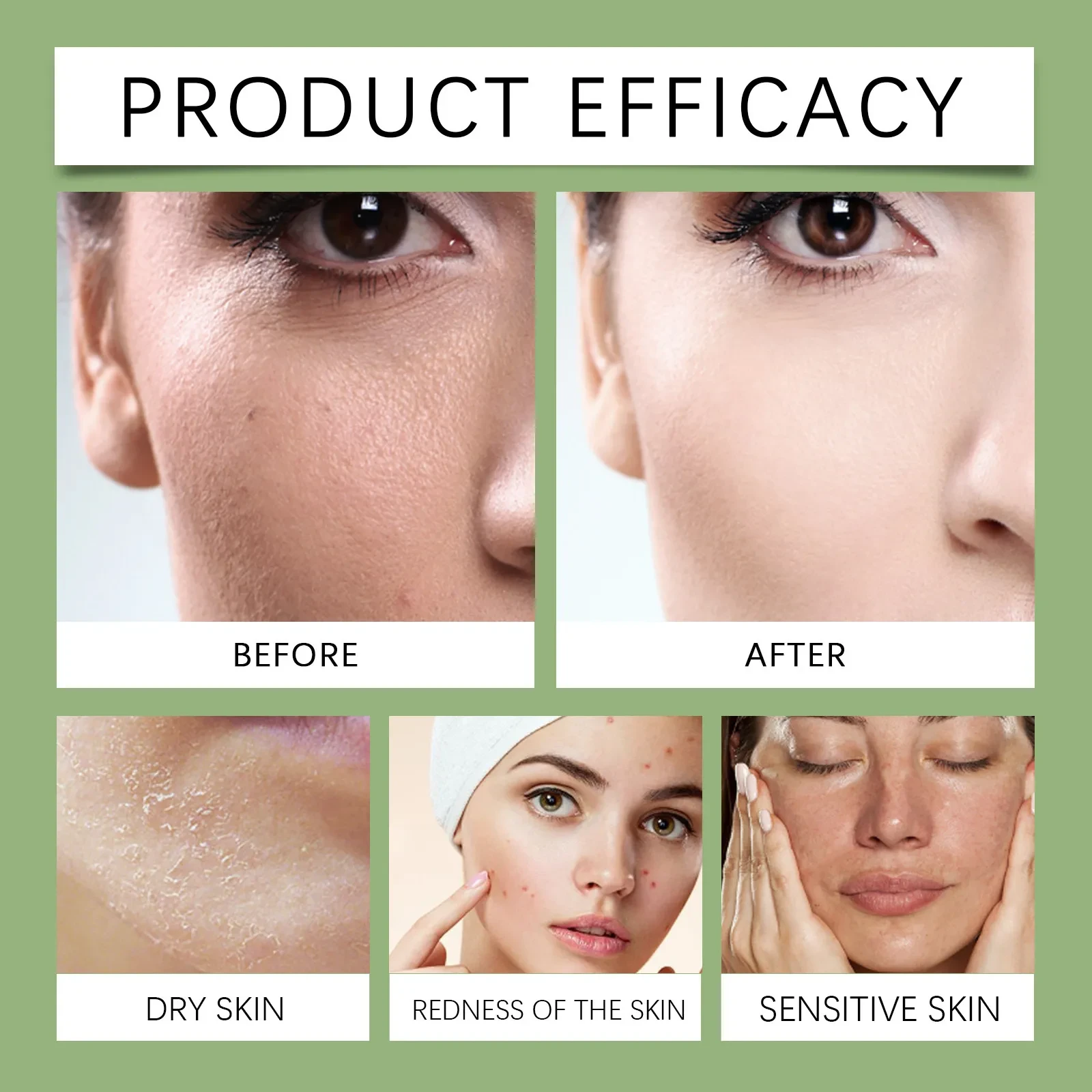 Gel hidratante facial con aloe para el cuidado de la piel
