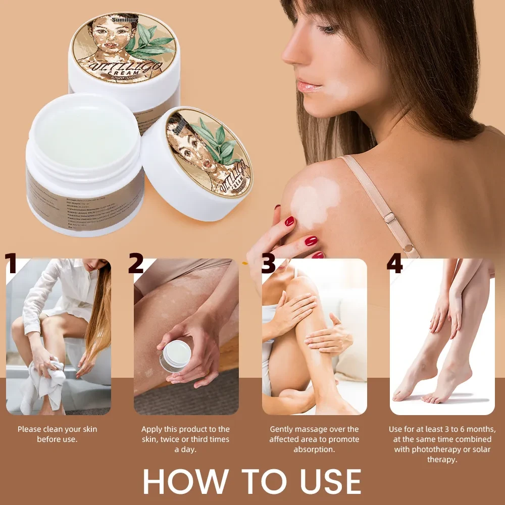 Crema antibacteriana para manchas blancas y piel blanca