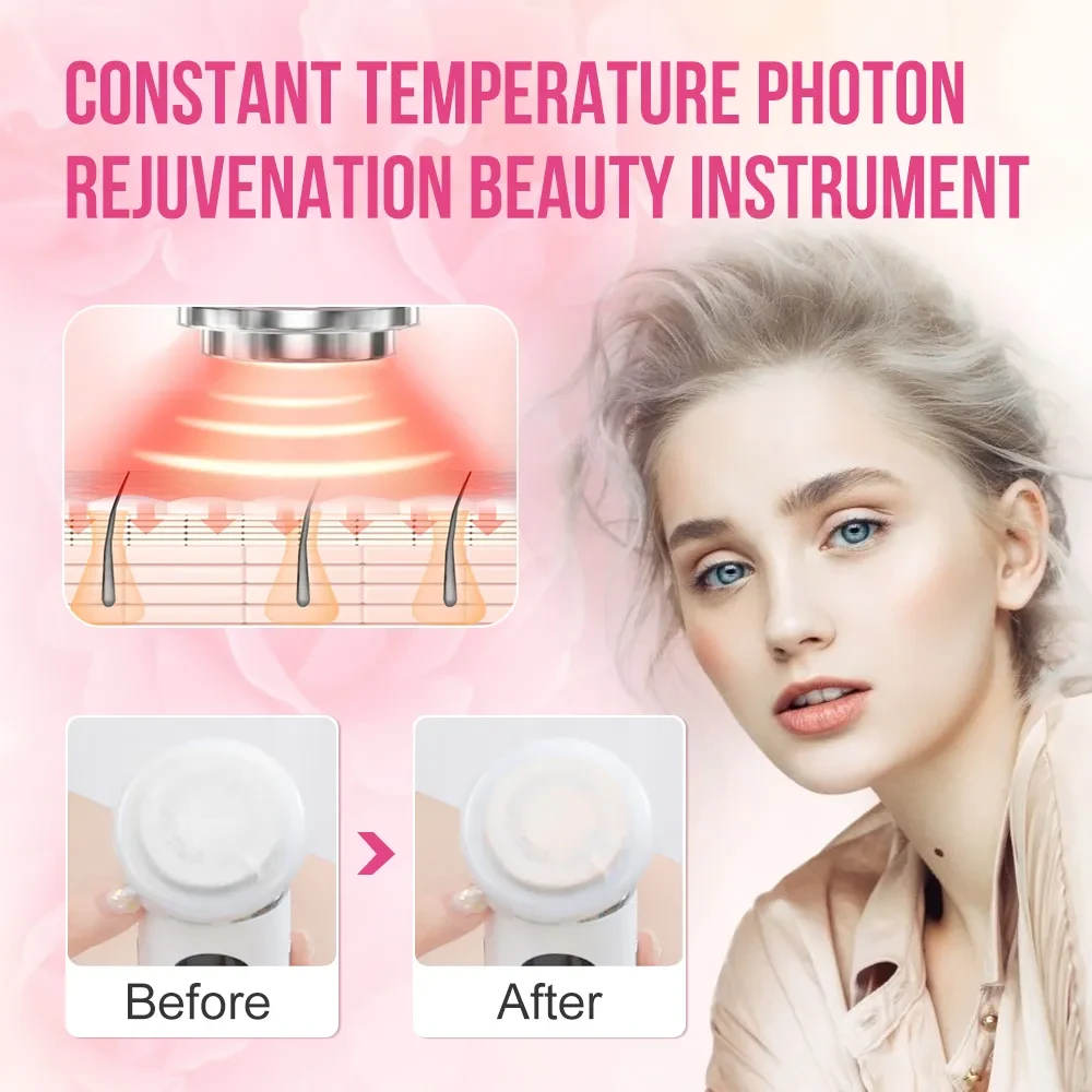 Dispositivo de rejuvenecimiento de la piel con IPL para lifting facial