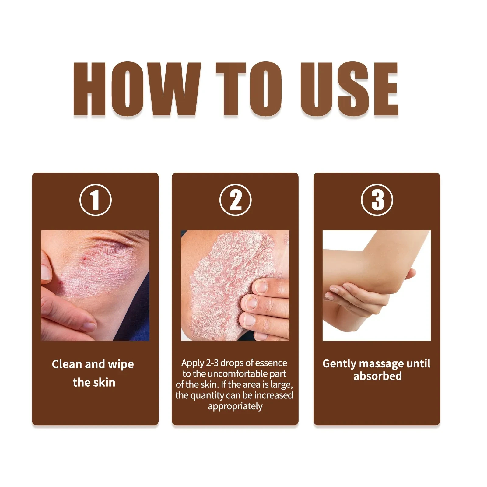 El aceite esencial Skin Moss Repair alivia la picazón