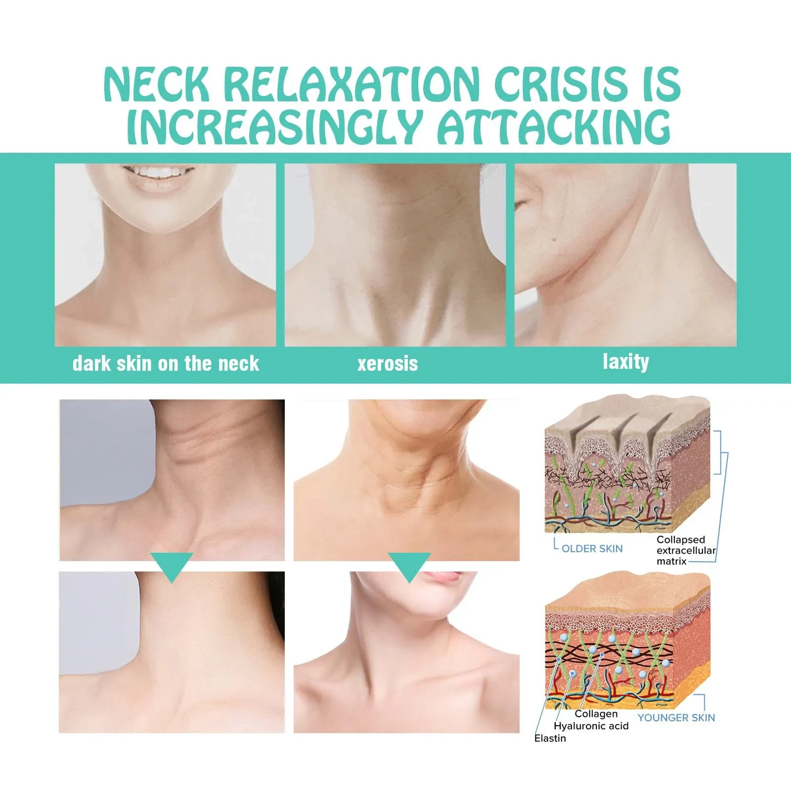 Difumina las líneas del cuello, tensa e ilumina la piel