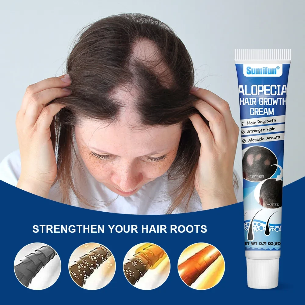 Crema para la cabeza y el cuello contra la alopecia areata (Sophora flavescens)