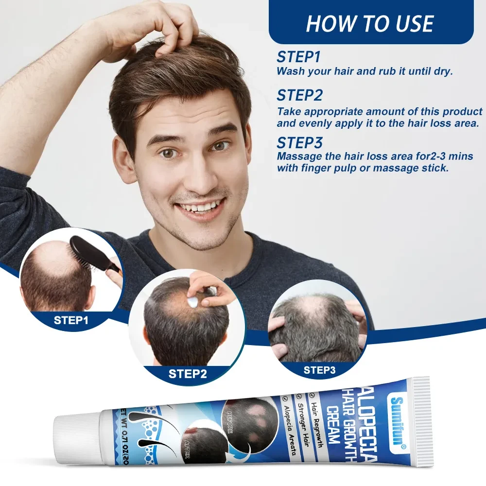 Crema para la cabeza y el cuello contra la alopecia areata (Sophora flavescens)