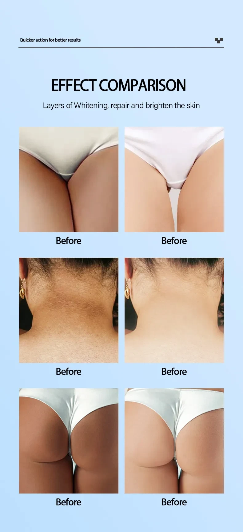 Crema blanqueadora Snow White para aclarar la piel y rejuvenecerla.