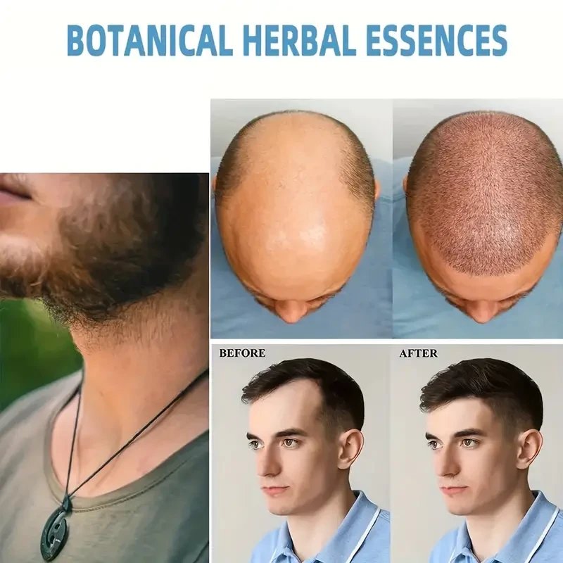 Crema capilar renovadora con biotina y queratina: aceite esencial para el cuidado capilar para mujeres y hombres. Penetra desde la raíz hasta las puntas para un cabello saludable.