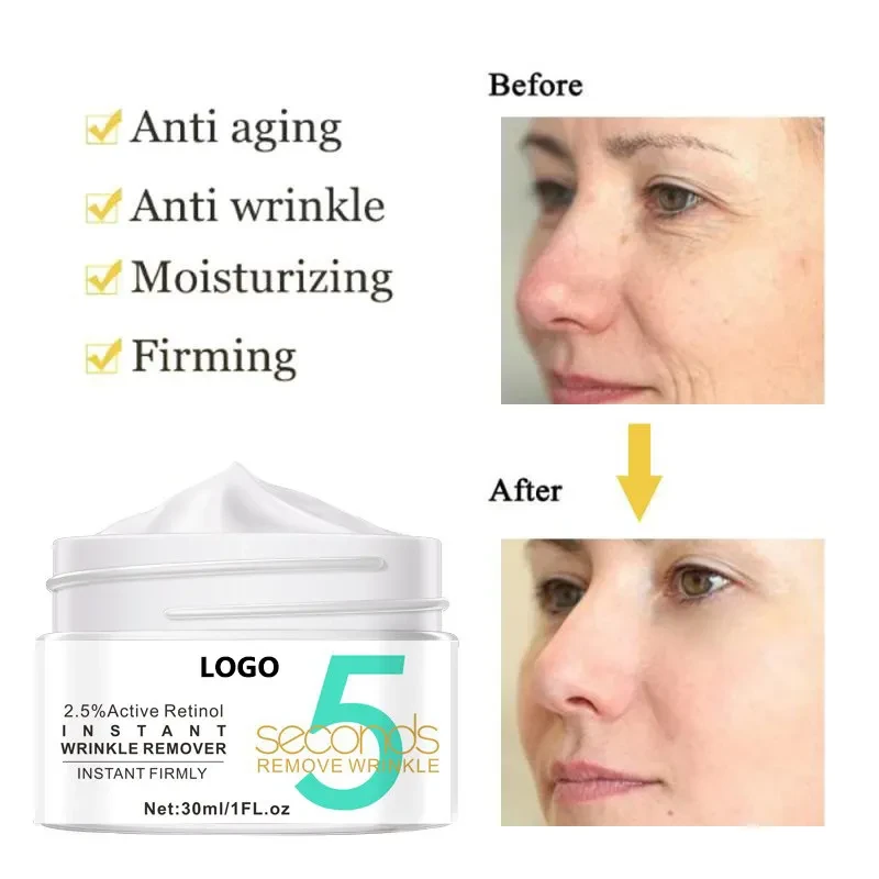 Crema facial con retinol activo, producto de cuidado de la piel de gran venta