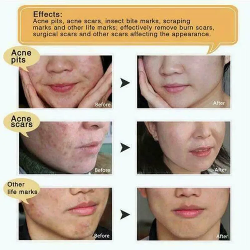 Loción para el cuidado de la piel de serpiente original Crema de manos