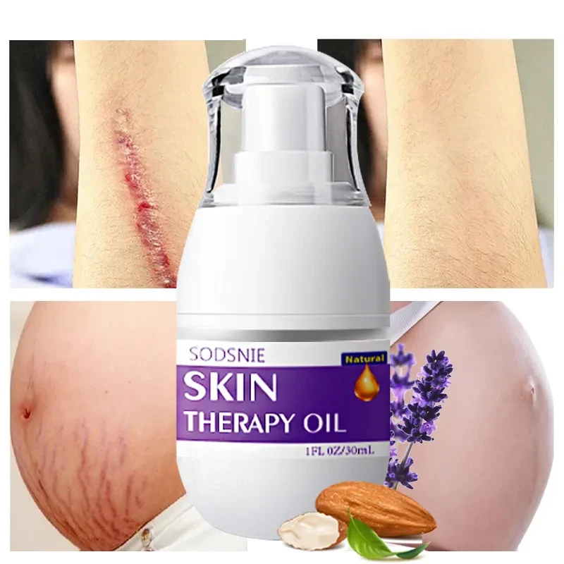 Aceite de tratamiento para eliminar pinchazos, celulitis y estrías