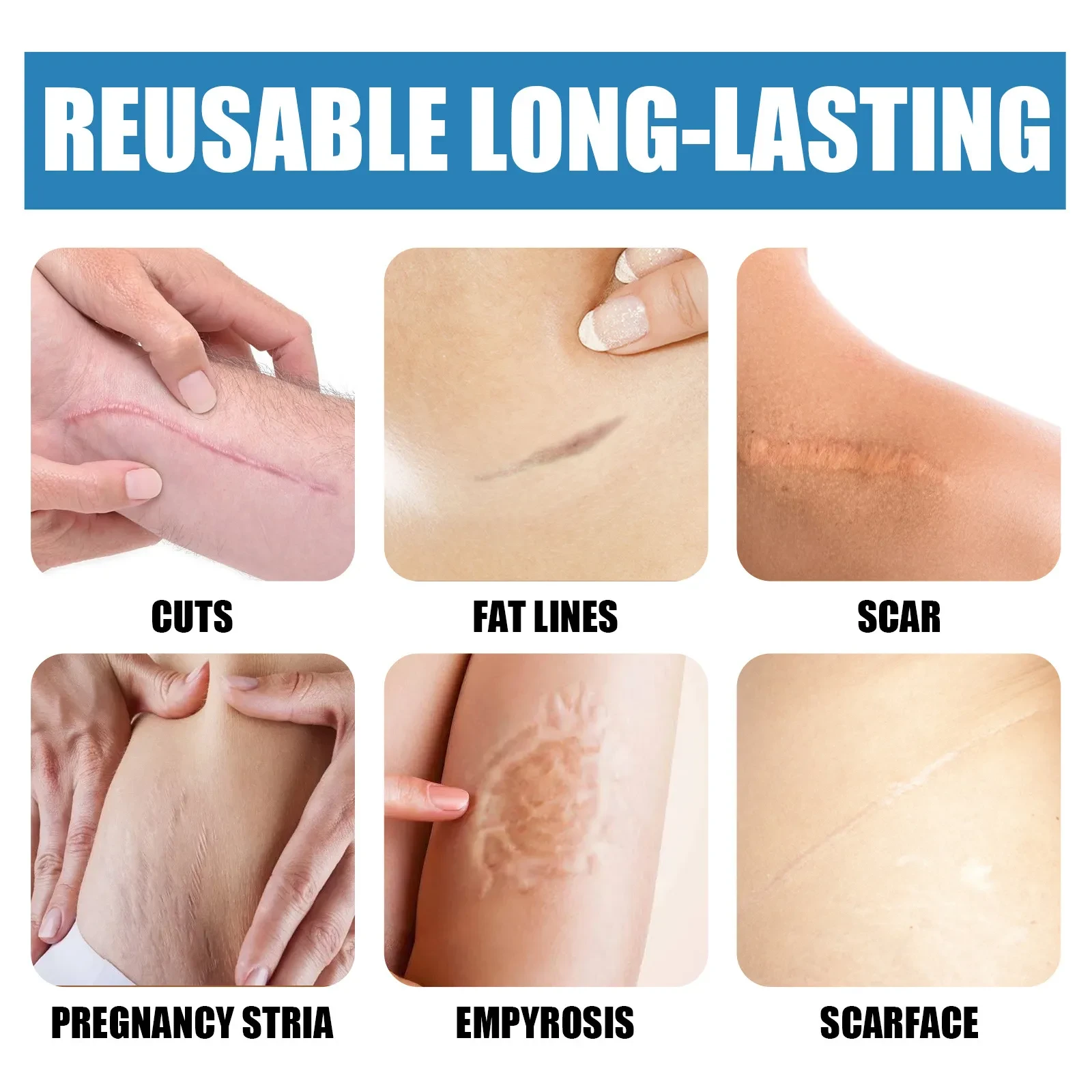 Lápiz para cicatrices Light Scar, reparador suave y difuminador de cicatrices en la piel