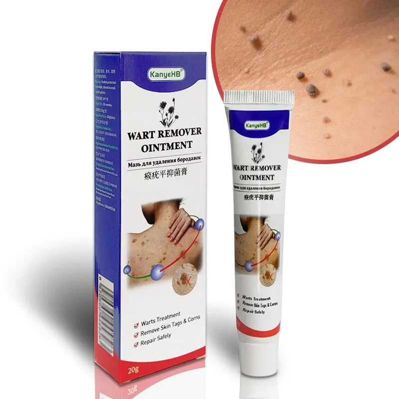 Crema para eliminar verrugas Wart Flat Monkey You
