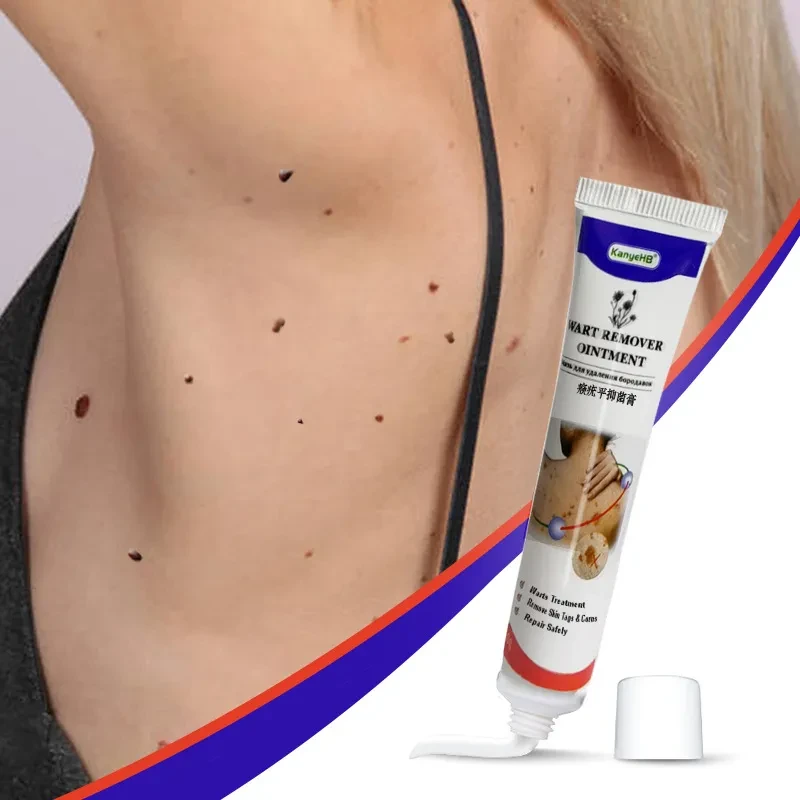 Crema para eliminar callos y verrugas Flat Monkey You